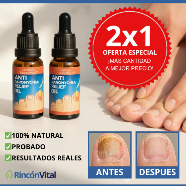 PACK 2 UNIDADES Anti Hongos Uñas - German Toenail Plus™ 2UND 30ml👋🦠