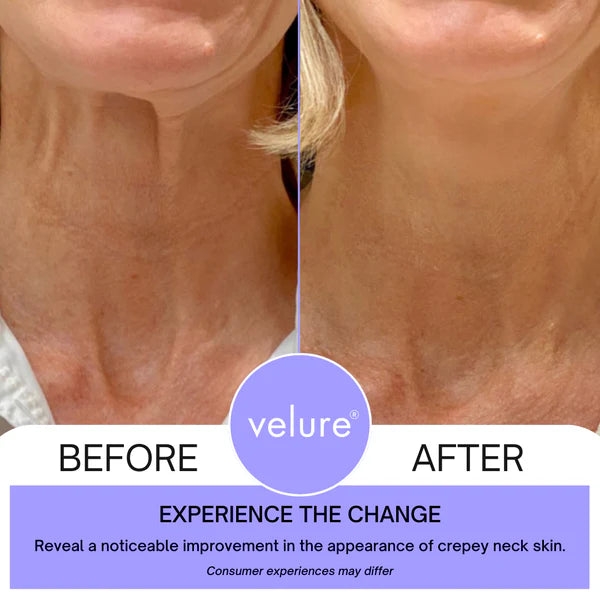 💜2x1 Neck Crema® Reafirmante Antienvejecimiento-Compra 1 y llévate 2💜