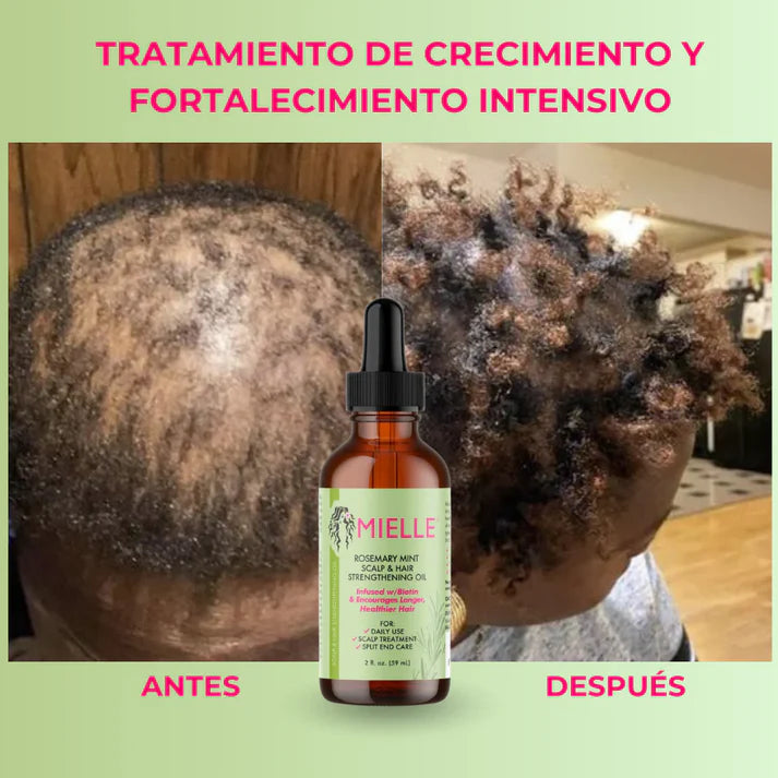 PACK 2 UNIDADES MIELLE® Serum Fortalecedor del Cabello💚 - OFERTA 2X1